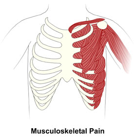 Muskuloskeletal Pain